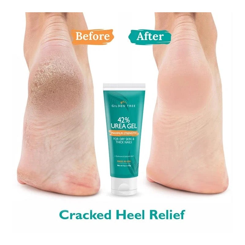 GILDEN TREE Urea Gel 42 Percent For Feet Maximum Strength
