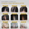 Vitamins Revive Vitaminas Crecimiento Capilar 180 Cpsulas Anti Cada Cabello