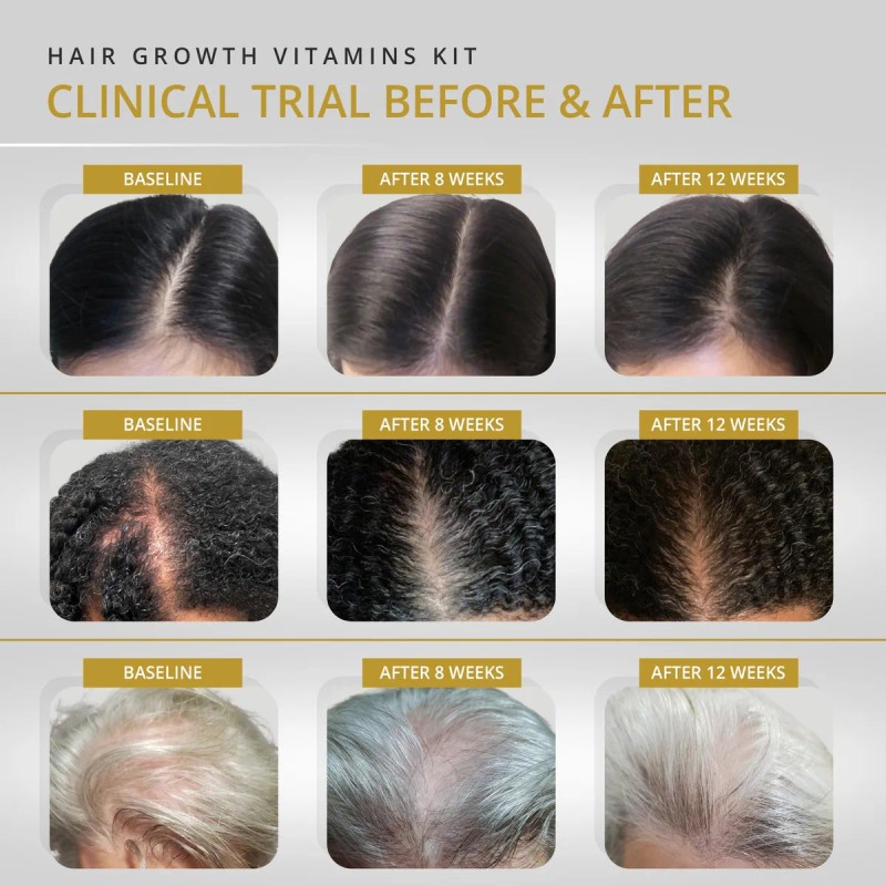 Vitamins Revive Vitaminas Crecimiento Capilar 180 Cpsulas Anti Cada Cabello