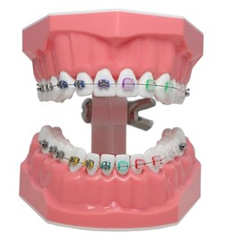 Dental Typodonts - Modelo de dientes de demostración de ortodoncia con alambres de metal, colores, ligaduras de cerámica, soportes de enseñanza, aprendizaje, modelo de educación para adultos y niños