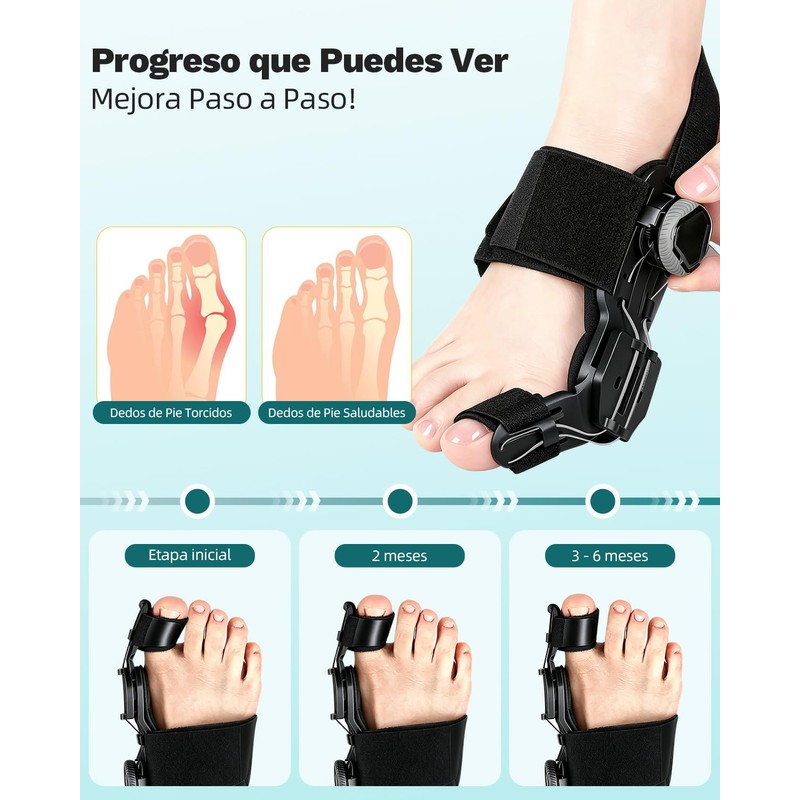 Corrector de Juanetes Ajustable,Aparato Ortopédico para Aliviar el Dolor
