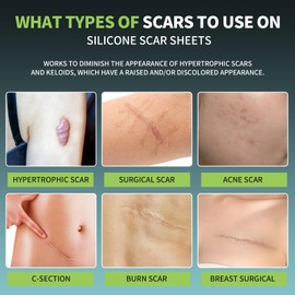 FANPARE Medical Grade Silicone Scar Sheets Scar Tape (1.6"x 6",20Pcs), Scar Strips Treatment & Prevention, Scar Tape for Surgical Scars,C-Section,Tummy Tuck,Keloid Bump Scars Removal