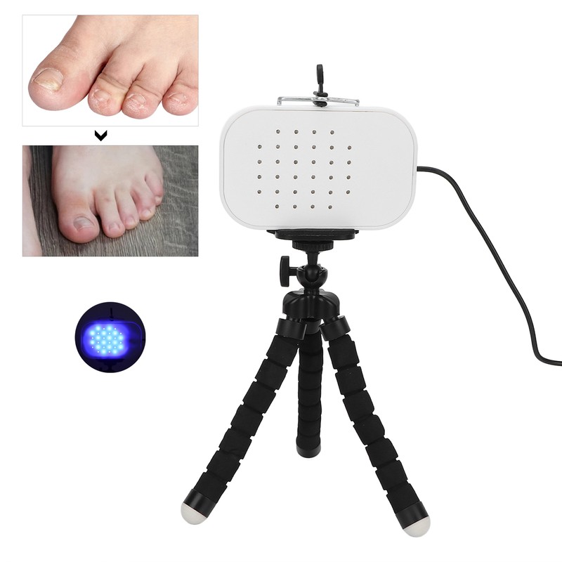 Leuconychia Remover Treatment Device Safe Quick Painless Portable Toe Nails