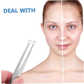 Baluue 2 Pcs Clip Stainless Popper Blackhead Pimple Remover Tools Pimple Tweezers Whitehead Removal Tool Face Scraper Tool Pimple Extractor Blemish Remover Stainless Steel