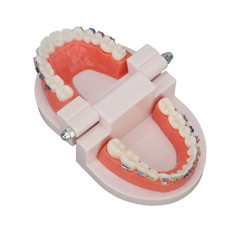 Dental Typodont Teeth Model with Orthodontic Metal Bracket for Dentist