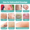 Hydrocolloid Roll for Wound Care - Flexible and Waterproof Bandages