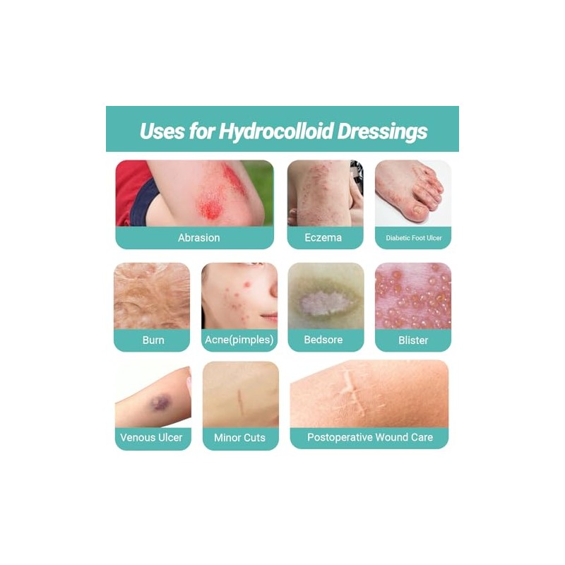 Hydrocolloid Roll for Wound Care - Flexible and Waterproof Bandages