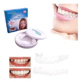 Carillas Estéticas Snap On Smile Veneers Dientes Temporales