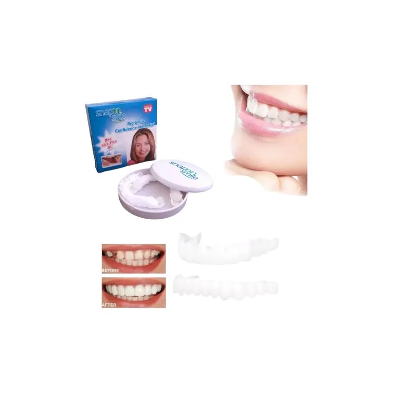 Carillas Estéticas Snap On Smile Veneers Dientes Temporales