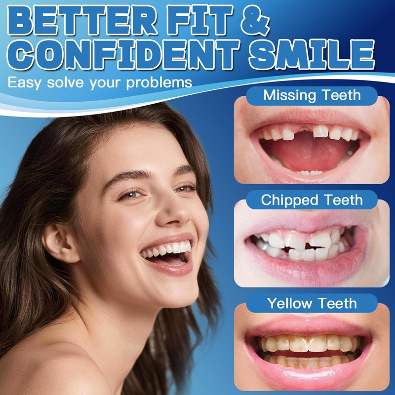 Moldable False Teeth Dentures Set for Women Men – Upper