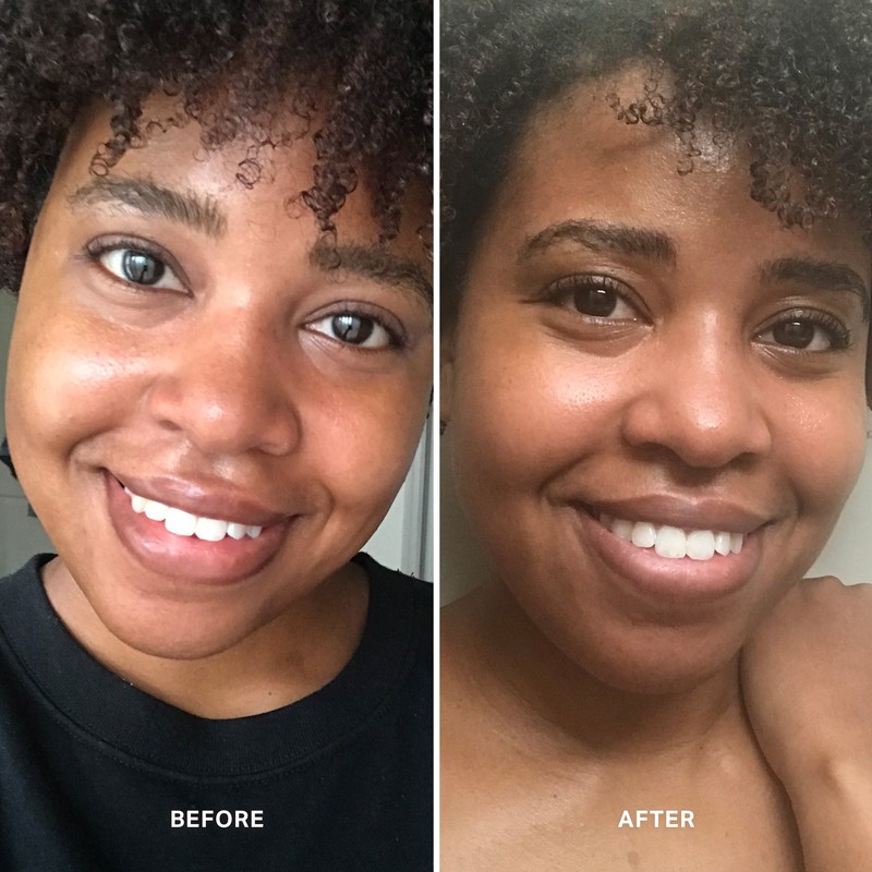 Alpha-H Vitamin C Serum with 10% Ethyl Ascorbic Acid 10ml