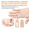 FOSDICK Pack of 20 Finger Splints, Breathable Buddy Loops Finger,