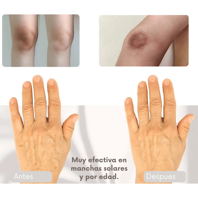 Crema Despigmentante Clear Tone - Manchas Solares Y Por Edad