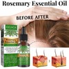 Aceite Natural de Romero para la Caída del Cabello Aceite