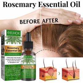 Aceite Natural de Romero para la Caída del Cabello Aceite de Romero para el Crecimiento del Cabello, Dañado Estimula el Crecimiento del Cabello Cuida el Cuero Cabelludo Seco