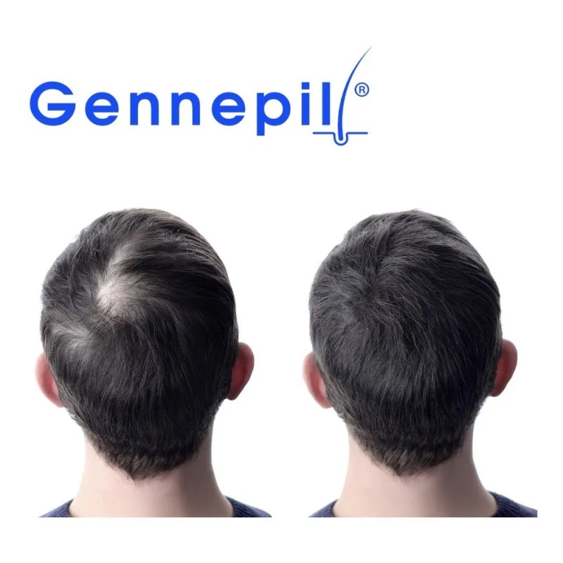 Loción Anticaída Y Crecimiento Capilar Gennepil 125ml