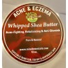 Mine Botanicals Acne & Eczema Whipped Shea Butter 12 oz