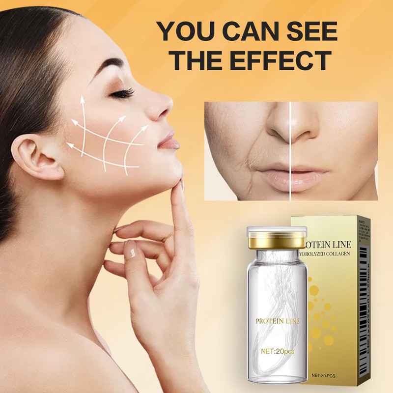 Landrain Pack of 100 Collagen Threads Lifting Set, Active Collagen