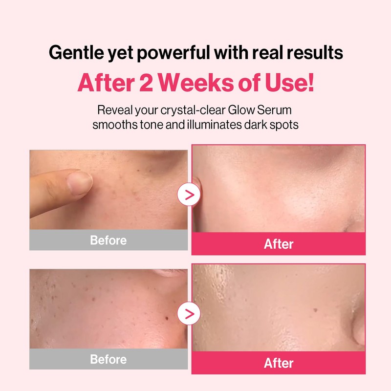 [Redence] 5% Niacinamide & 605,395ppm Natural Vitamin C Tone &