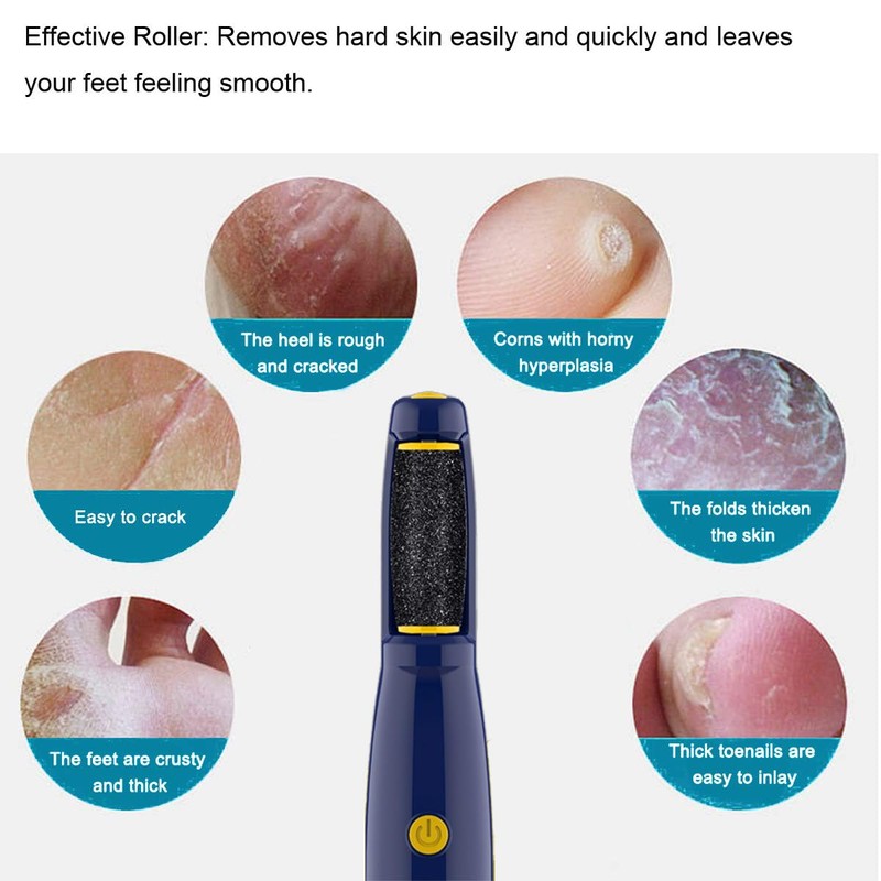 Replacement Roller Compatible with Dr. Scholl's Callus Remover Electronic Foot