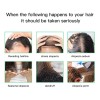 Kit Tratamiento Para El Cabello Aceite De Romero Y Fijadores