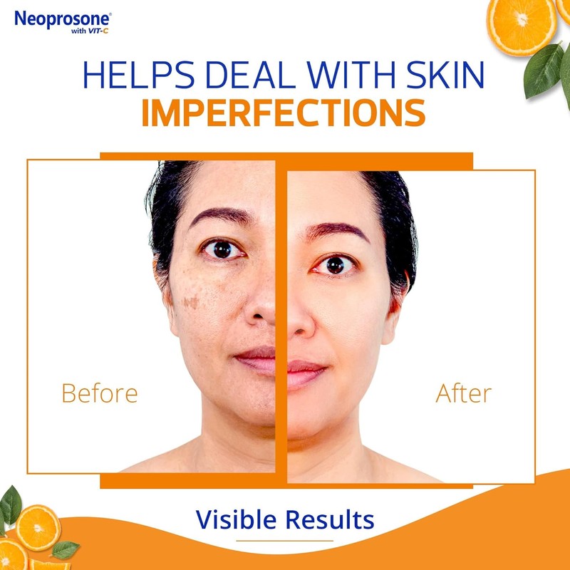 Neoprosone 20% Vitamin C Dark Spot Corrector Cream - 1