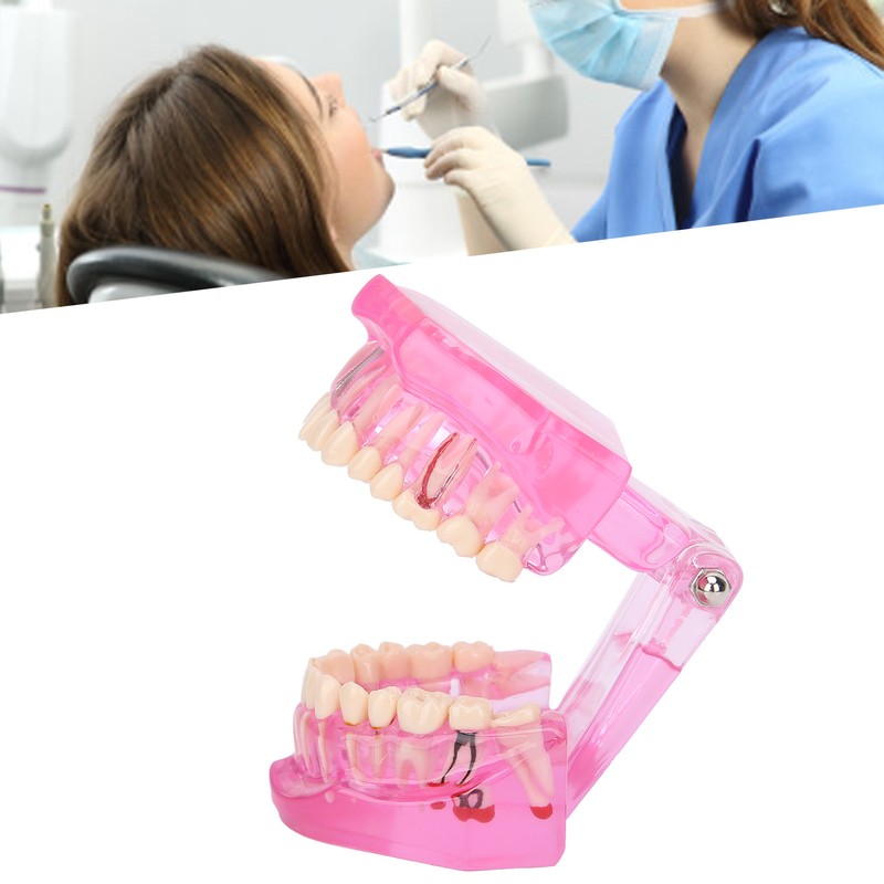 Transparent Adult Teeth Model Pathological Repair Studying Dental Teaching Tools