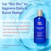Tend Skin Care Solution for Ingrown Hairs & Razor Bumps,