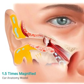 LVCHEN Human Ear Model Anatomy - Anatomical 3D Ear Model 1.5 Times Enlarged Show Outer Middle Inner Ear Model Professional Medical Classroom Demonstration Doctors Office Desktop & Display Base