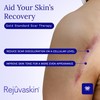 Rejuvaskin Scar Esthetique Cicatrices Crème con silicona, 1 oz