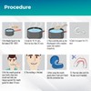 Mouth Guard for Grinding Teeth Upgraded Night Guard for Teeth