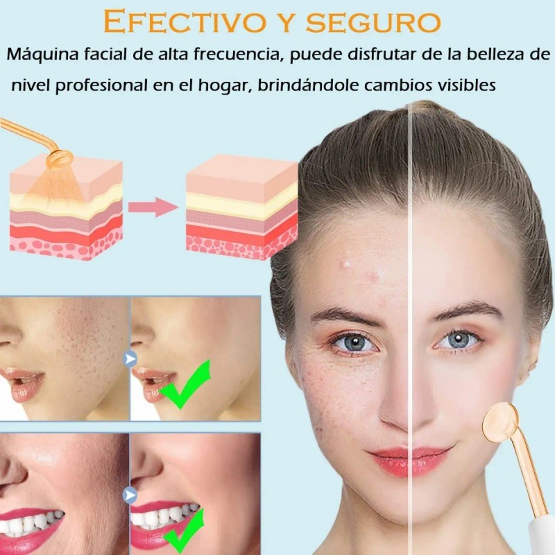 Máquina Terapia Piel, Facial Dispositivos De Alta Frecuencia
