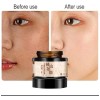 Crema Despigmentante De Manchas Paño Melasma Pecas Blanquea