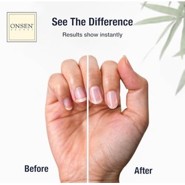 Onsen Nail & Cuticle Cream Treatment w/Japanese Tsubaki, Jojoba & Lavender Oil, Shea Butter – Strengthens Nails, Softens Cuticles - Daily Repair Care (1 Count/30 ml)