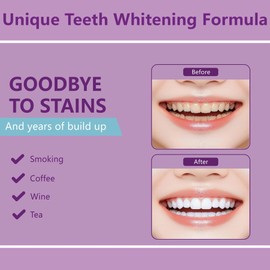 Teeth Whitening Strips Fast Acting for Removing Smoking, Coffee, and Wine Stains - Teeth Brightening Kit with 28 Non-Slip Strips