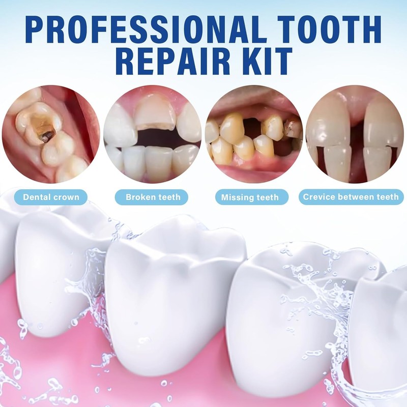 HUFLYI Zinc oxide-eugenol Cement Dental Kit affix temporary crowns or