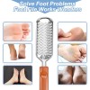 Foot Rasp File Pedicure Callus Remover Hard Dead Skin Scrubber
