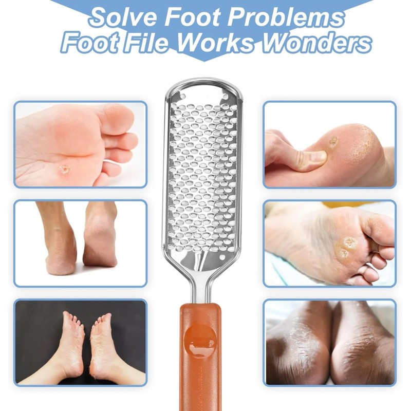 Foot Rasp File Pedicure Callus Remover Hard Dead Skin Scrubber