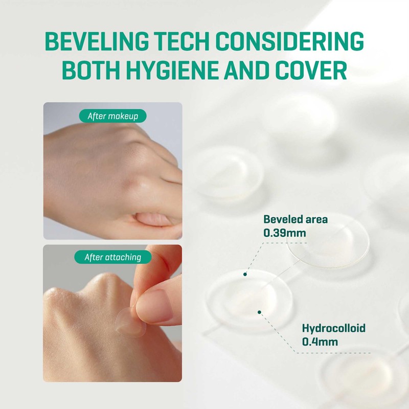 SOME BY MI 30 Days Miracle Clear Spot Patch -
