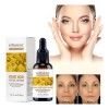 Tratamiento Serum Aclarante Manchas Paño Pecas Acne 30ml