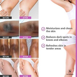 AICHUN BEAUTY Hot 50g Whitening Safe natural ingredients cream Get Rid of Dark Armpit/Inner thigh/Elbow/Knee Fast