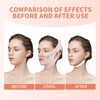 Chin Strap for Sleeping, Reusable Double Chin Reducer Eliminator for