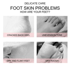 Rose Foot Mask - Foot Care Moisturiser Foot Exfoliating Sock - 3PCS Foot Peel Mask for Hard Skin - Foot Mask Peel for Callus Remove - Repair Cracked Heel - Foot Peel Mask for Women and Men