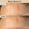 Mascarilla Beauty Joseon Facial Arroz