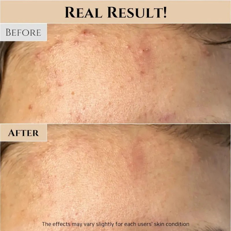 Mascarilla Beauty Joseon Facial Arroz
