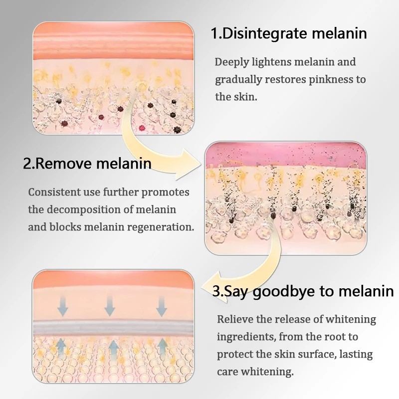 LYDIMOON Underarm melanin removal cream Neck/armpit/elbow/Black acanthoderm precipitation desalination private