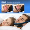 SnoreShield Anti Snore Chin Strap - The #1 Ranked Snoring
