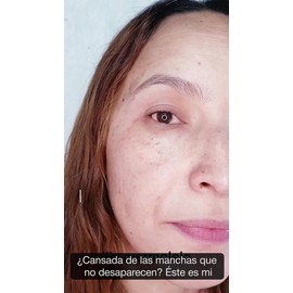 Pureza Natur Serum Aclarante De Paño Manchas Facial y Ácido Hialurónico suero reductor de hiperpigmentación y mancha obscura facial Todo tipo de piel 