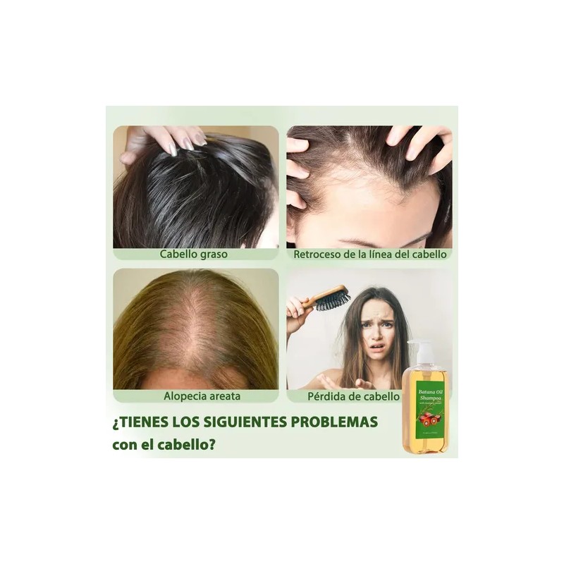 Champú Batana, Crecimiento Del Cabello.