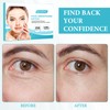 Frownies Anti Wrinkle Patches Wrinkle Patch Face Wrinkle Remover Strips
